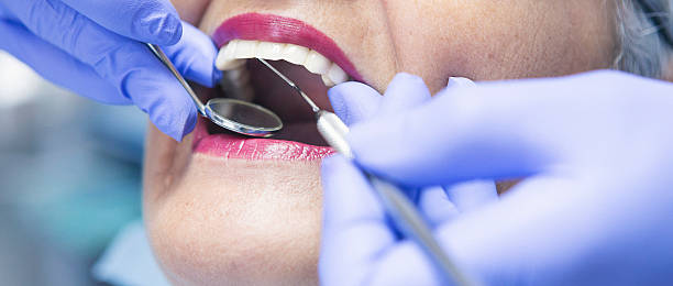 Best Dentist for Tooth Abscess  in Gering, NE